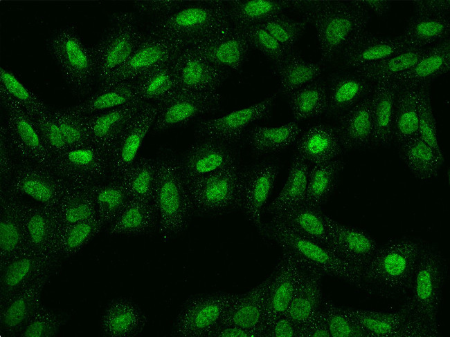 SPATA31E1 Antibody in Immunocytochemistry (ICC/IF)