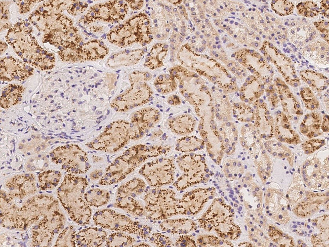 HMCN1 Antibody in Immunohistochemistry (Paraffin) (IHC (P))