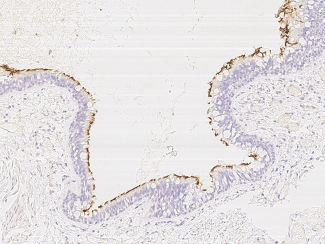 CCDC114 Antibody in Immunohistochemistry (Paraffin) (IHC (P))
