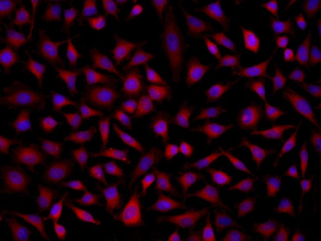 SOAT2 Antibody in Immunocytochemistry (ICC/IF)