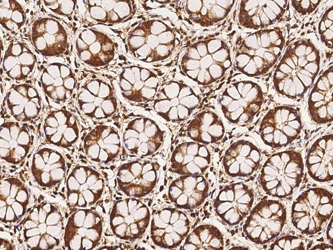 MFSD11 Antibody in Immunohistochemistry (Paraffin) (IHC (P))