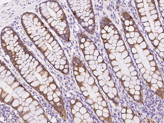 ZNF410 Antibody in Immunohistochemistry (Paraffin) (IHC (P))
