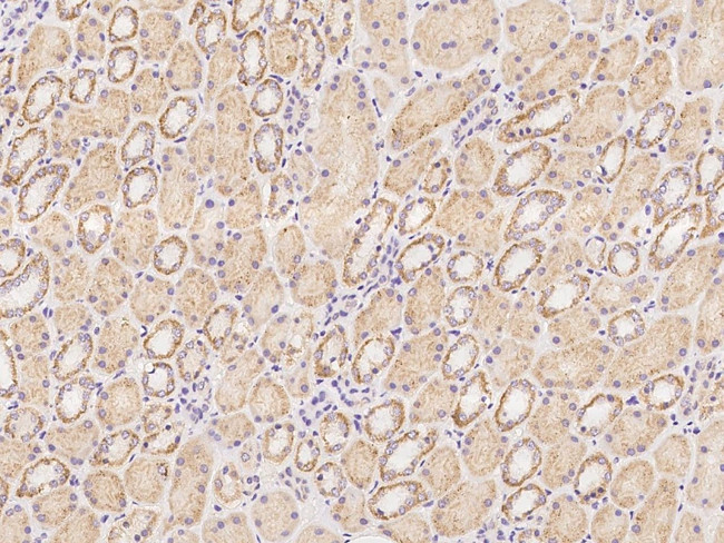 OTOP1 Antibody in Immunohistochemistry (Paraffin) (IHC (P))