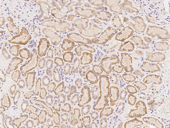 FER1L6 Antibody in Immunohistochemistry (Paraffin) (IHC (P))