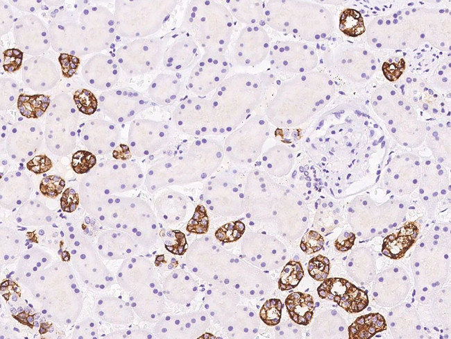 TBC1D10B Antibody in Immunohistochemistry (Paraffin) (IHC (P))