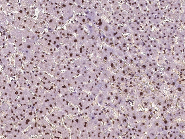 ZDHHC12 Antibody in Immunohistochemistry (Paraffin) (IHC (P))