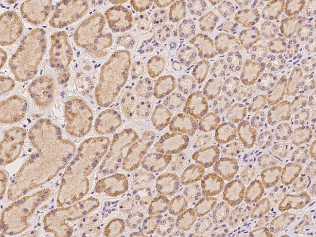 HRASLS Antibody in Immunohistochemistry (Paraffin) (IHC (P))
