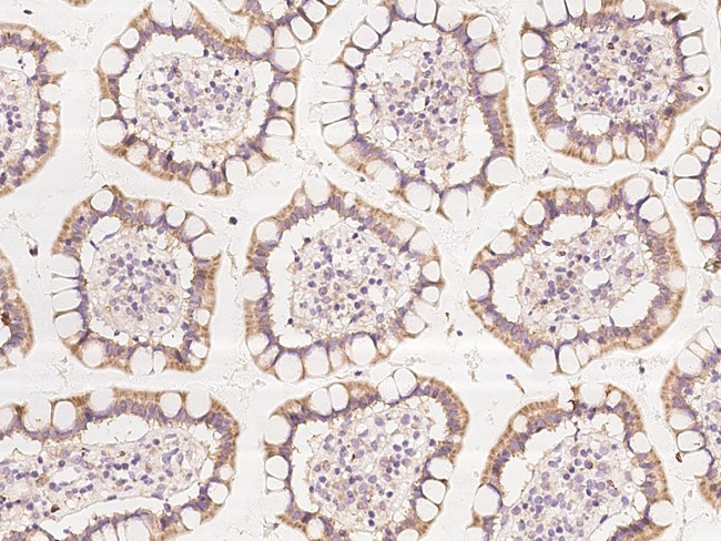 ZNF354C Antibody in Immunohistochemistry (Paraffin) (IHC (P))