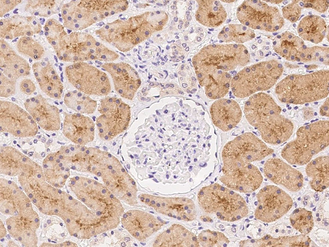 KLHL17 Antibody in Immunohistochemistry (Paraffin) (IHC (P))