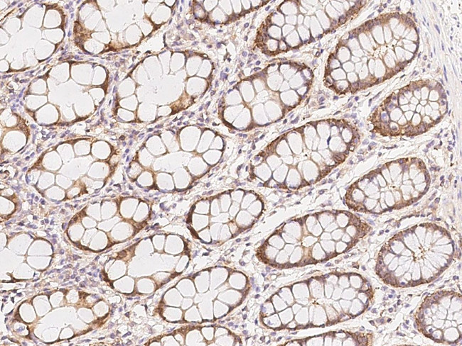 ZNF720 Antibody in Immunohistochemistry (Paraffin) (IHC (P))
