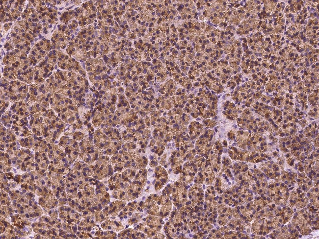 HEATR4 Antibody in Immunohistochemistry (Paraffin) (IHC (P))