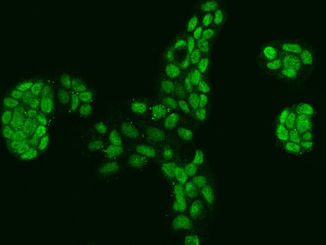 PPP1R26 Antibody in Immunocytochemistry (ICC/IF)