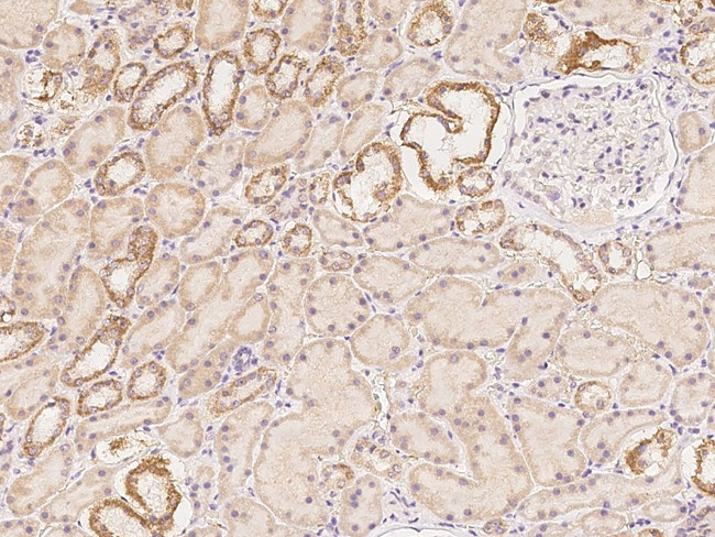 PCBP4 Antibody in Immunohistochemistry (Paraffin) (IHC (P))