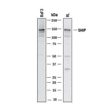 SHIP1 Antibody in Western Blot (WB)