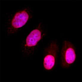 PPM1D Antibody in Immunocytochemistry (ICC/IF)