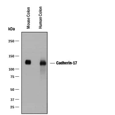 CDH17 Antibody in Western Blot (WB)