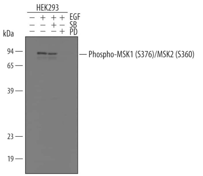 Phospho-MSK1/MSK2 (Ser376/Ser360) Antibody in Western Blot (WB)