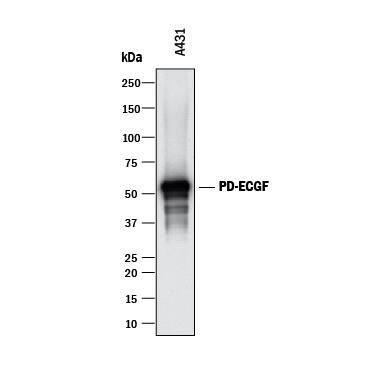 Thymidine Phosphorylase Antibody in Western Blot (WB)