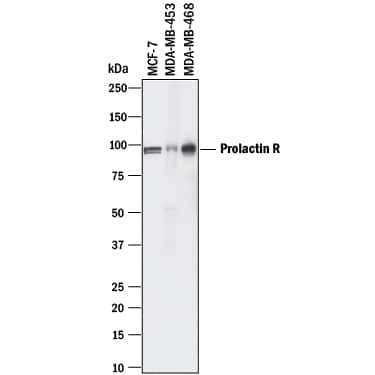 Prolactin Receptor Antibody in Western Blot (WB)