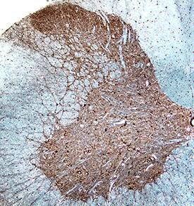 GABBR2 Antibody in Immunohistochemistry (Frozen) (IHC (F))