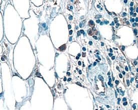 FGF3 Antibody in Immunohistochemistry (Paraffin) (IHC (P))