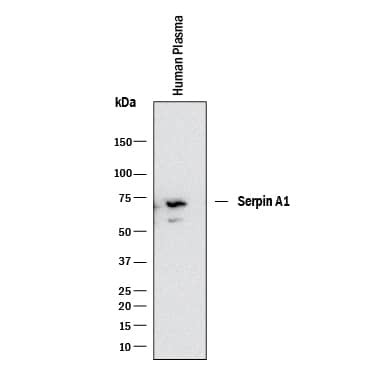 alpha-1 Antitrypsin Antibody in Western Blot (WB)