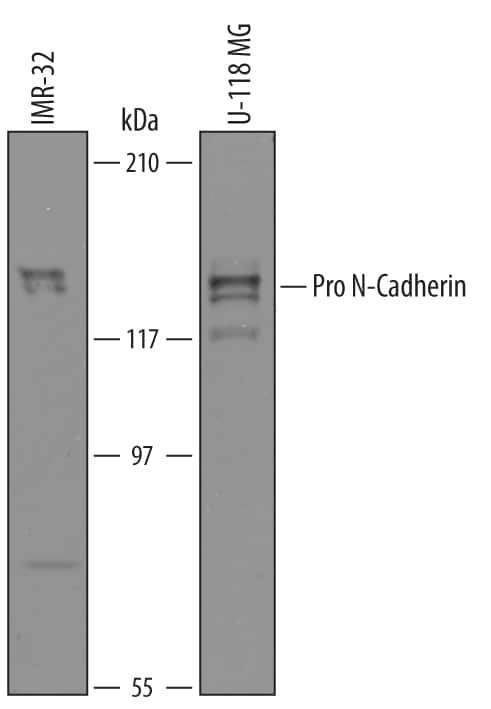 pro-N-cadherin Antibody in Western Blot (WB)