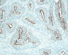 DcR3 Antibody in Immunohistochemistry (Paraffin) (IHC (P))