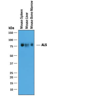 ALS Antibody in Western Blot (WB)