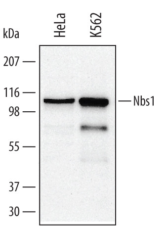 NBS1 Antibody in Western Blot (WB)