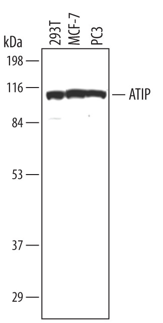 ATRIP Antibody in Western Blot (WB)