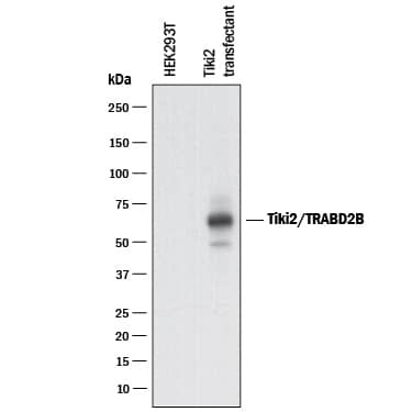 TRABD2B Antibody in Western Blot (WB)