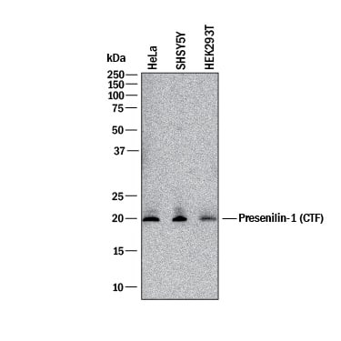 Presenilin 1 Antibody in Western Blot (WB)