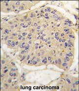 FKBP12 Antibody in Immunohistochemistry (Paraffin) (IHC (P))