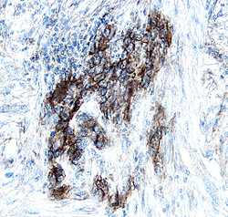S100A10 Antibody in Immunohistochemistry (Paraffin) (IHC (P))