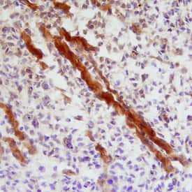 IHH Antibody in Immunohistochemistry (Frozen) (IHC (F))