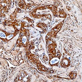 MMP16 Antibody in Immunohistochemistry (Paraffin) (IHC (P))