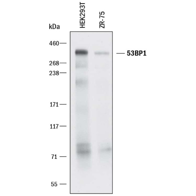 53BP1 Antibody in Western Blot (WB)