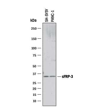 FRZB Antibody in Western Blot (WB)