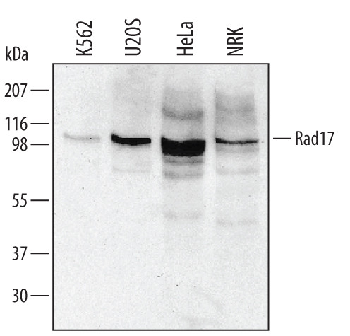 RAD17 Antibody in Western Blot (WB)