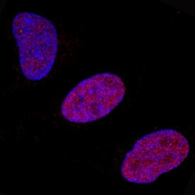 FosB Antibody in Immunocytochemistry (ICC/IF)