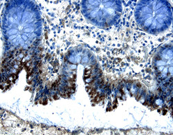 SMAD5 Antibody in Immunohistochemistry (Paraffin) (IHC (P))