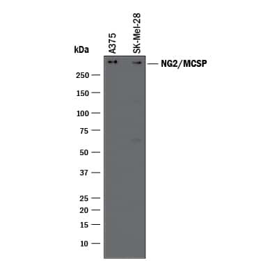 NG2 Antibody in Western Blot (WB)