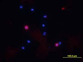 CD8a Antibody in Immunocytochemistry (ICC/IF)