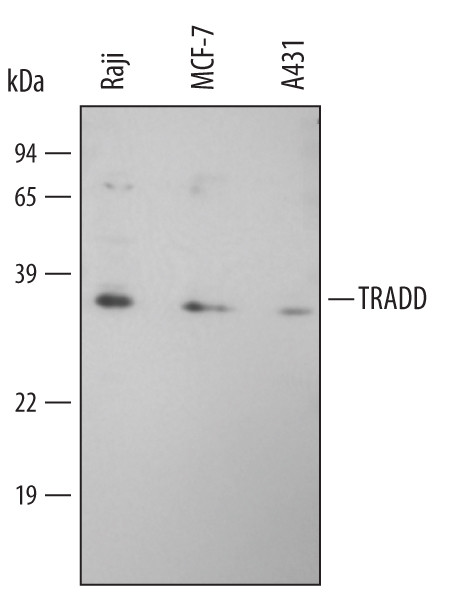 TRADD Antibody in Western Blot (WB)