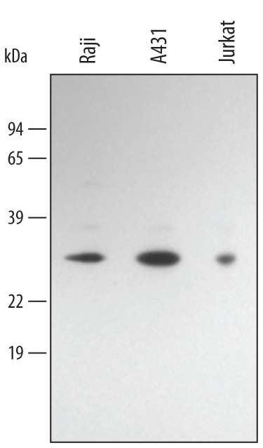 BCL-10 Antibody in Western Blot (WB)