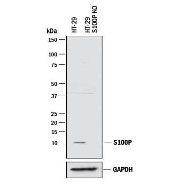 S100P Antibody in Western Blot (WB)