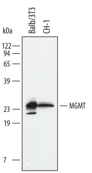 MGMT Antibody in Western Blot (WB)