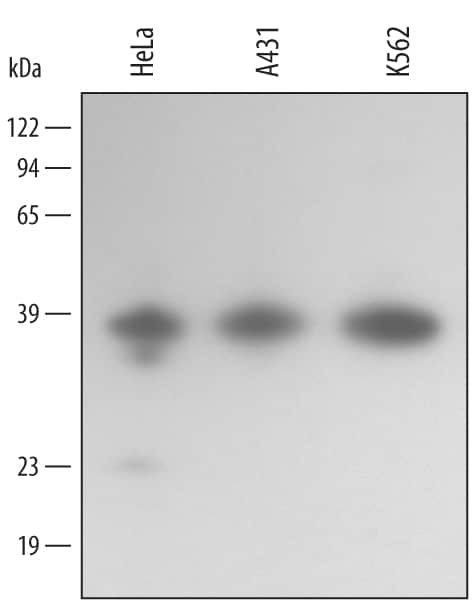 Annexin A10 Antibody in Western Blot (WB)