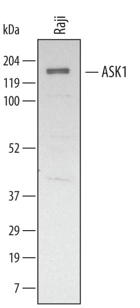 ASK1 Antibody in Western Blot (WB)